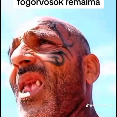 Nájk Zsòt a fogorvosok rémálma