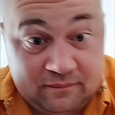 Mc Isti közel volt hogy Down Syndrome-os legyen amikor született