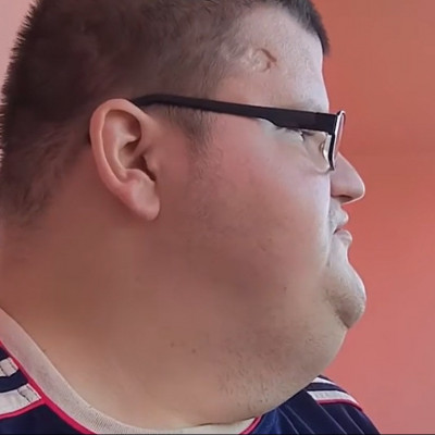 Dagadt nagy hombár feje