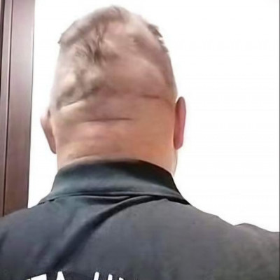 Mc Isti torz feje hátulròl