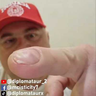 Mc isti eldeformálòdott (valòszínűleg beteg) körme