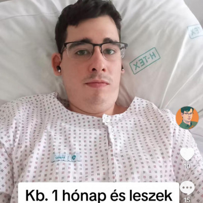 Üdvözlendő hir: Jenes karanténba került a lepra miatt. - Kórházi selfie torz, burgonyafejjel