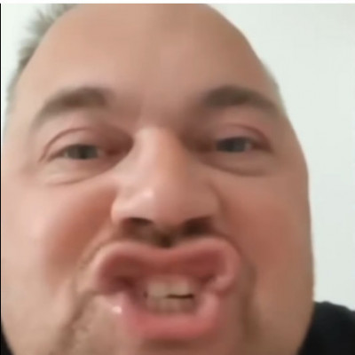 MC Árvácska száj a kamerába vicsorog