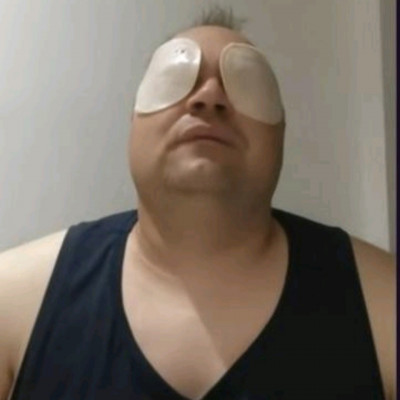 Mc Parizerszemű Felvizesedett Pityek