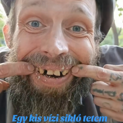 Bartos Möster megnyerő, Hollywoodi mosolya