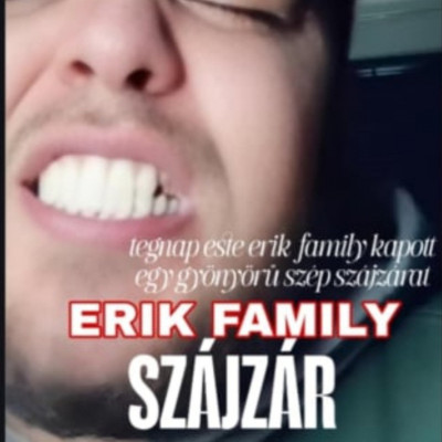 ErkiFàmillííí szàjzárat kapott