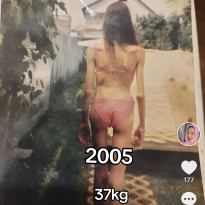 Csontvàz fizimiskajú Rodalexa büszke magàra