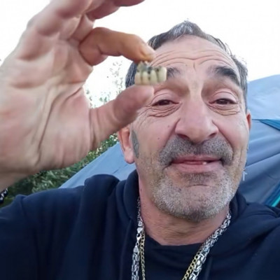 Üdvözlendő Hìr: sittes Táky fogai kitörtek