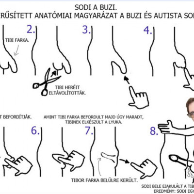 Anatòmiai magyarázat Sodinak