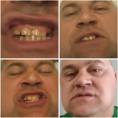 Legkomolyabb külföldi prémium szájzárak