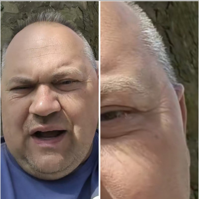 Malackènyi benőtt füle