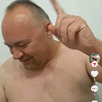 MC isti fejèn a Fülek eltűntek de a testèn megjelentek...