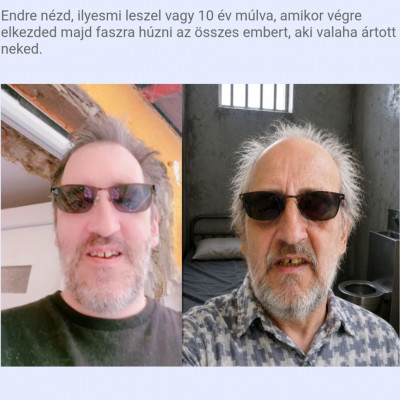 Ilyen lesz Endre 10 èv múlva?