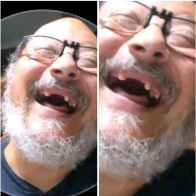Dentàl holokauszt Tojás Bácsi