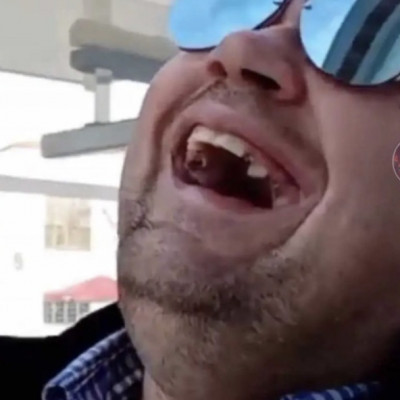 Mc Szalonna szénné rohadt fogai