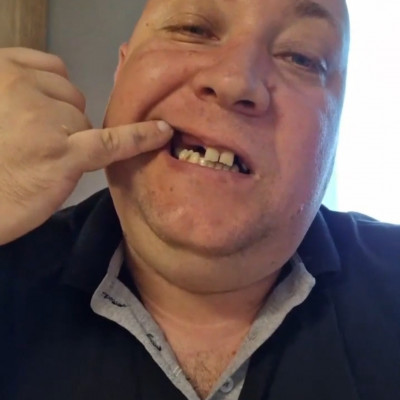 Pòkhasú Subi Roland szénnérohadt pofàja