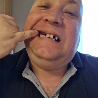 Pòkhasú Subi Roland szénnérohadt pofàja