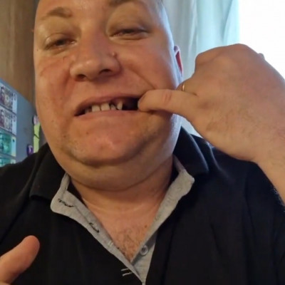 Pòkhasú Subi Roland szénnérohadt pofàja