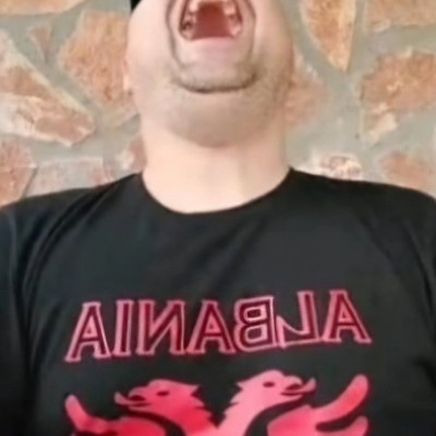 Mc Isti jò sok Cukros energiaitalt iszik és a fogai is egyre csak hullanak kifele