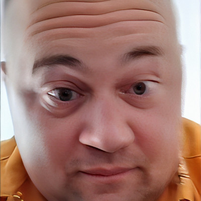 Mc Isti közel volt hogy Down Syndrome-os legyen amikor született