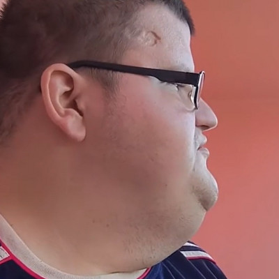 Dagadt nagy hombár feje