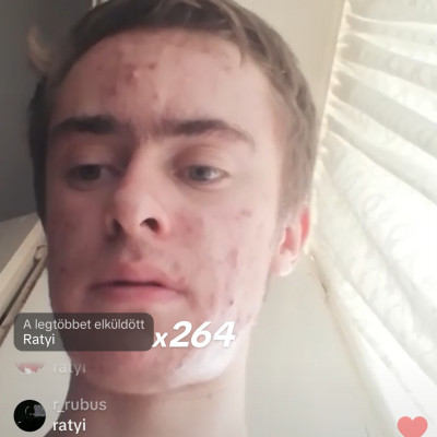 Jolly live screenshot és szőrös hónalja