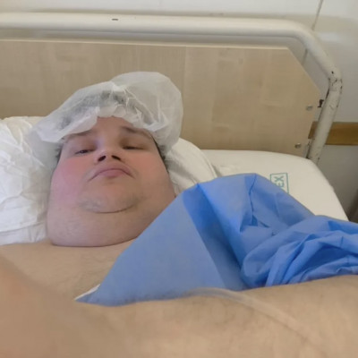 Molnár Krisztián lábujj levágós műtét utáni sertés selfie