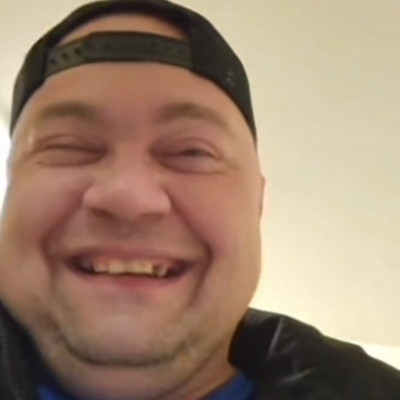 MC Isti màsfél év alatt megritkult fogai