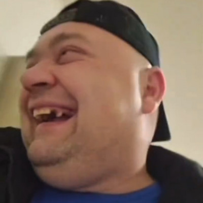 MC Isti màsfél év alatt megritkult fogai