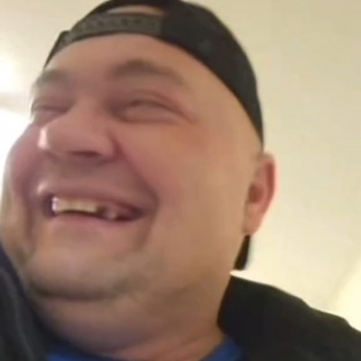 MC Isti màsfél év alatt megritkult fogai