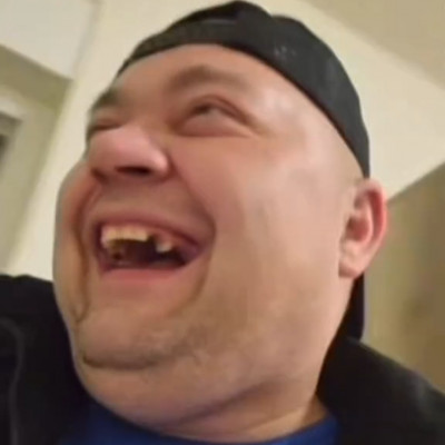 MC Isti màsfél év alatt megritkult fogai