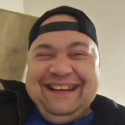 MC Isti màsfél év alatt megritkult fogai