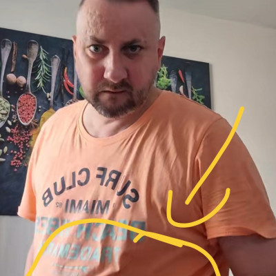 Alkesz Beszarimi pálcika karokkal ès kifelé növő köldökkel
