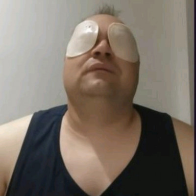 Mc Parizerszemű Felvizesedett Pityek