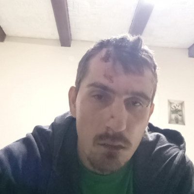 Trutymò Brutàlis Vèraláfutásos, betört, Zombi fejjel