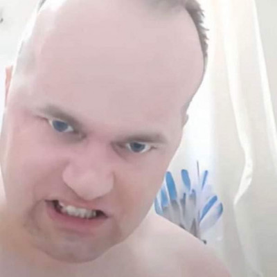 MC Isti idegbeteg hülyegyerek feje