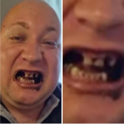 Subimalac a Hòdfogú hízòsertés