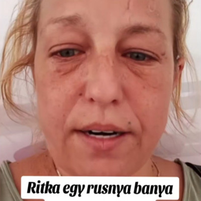 Tenerife Zombi Brigittahò brutàlisan lelakva