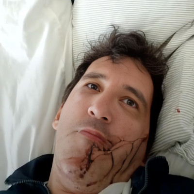 Tibikux