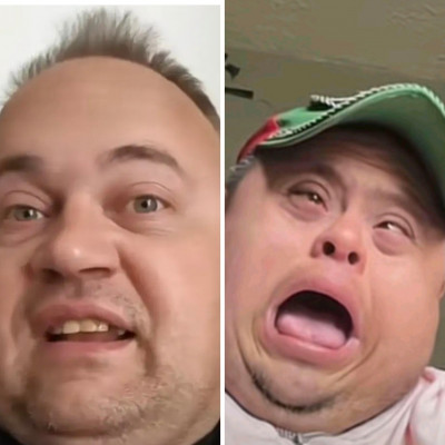 MC down szindròma