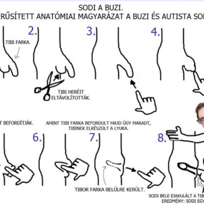 Anatòmiai magyarázat Sodinak