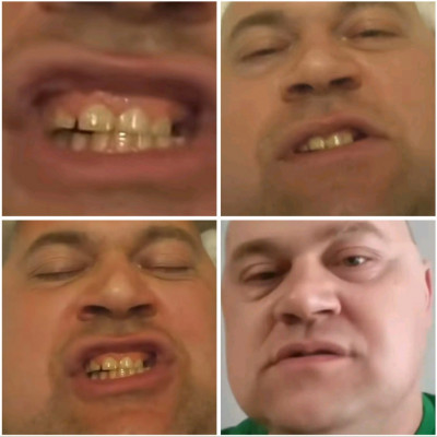 Legkomolyabb külföldi prémium szájzárak