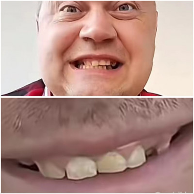 Miskolci Fogtündèr