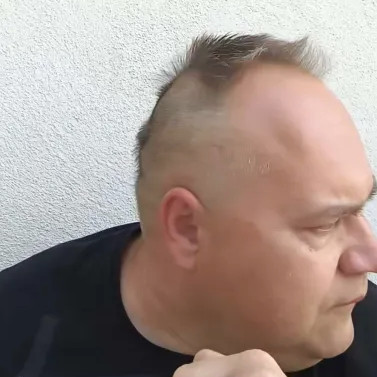 MC Frizura legújabb hajkölteménye