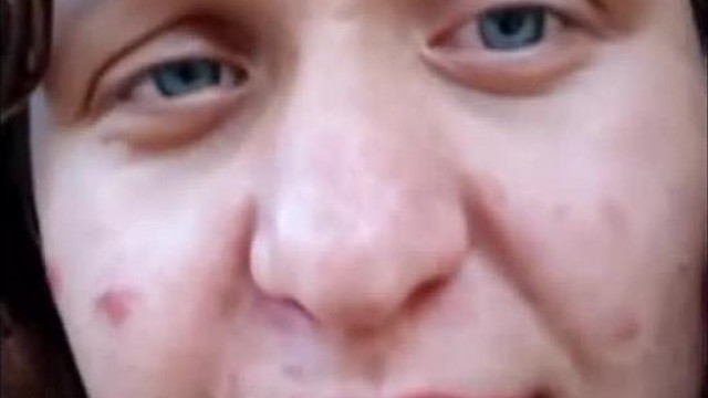 Robbant arcú Boglárka legùjabb gyűlölködése tik tok liveban
