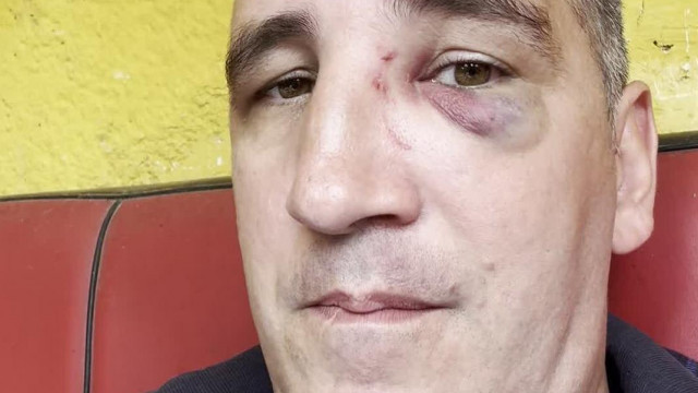 Szétvert Fejű Sodi legùjabb Vlogja: "Tisztázzuk a dolgokat, nem vagyok PEDOFIL!" (2024.7.2)