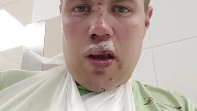 Koldulex összetörte magát bicajozás közben, nyomjatok egy likeot!