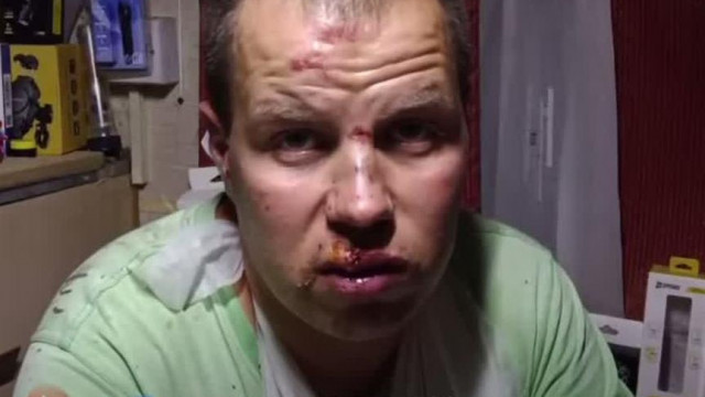 Alex elesett a bringával (live részlet)