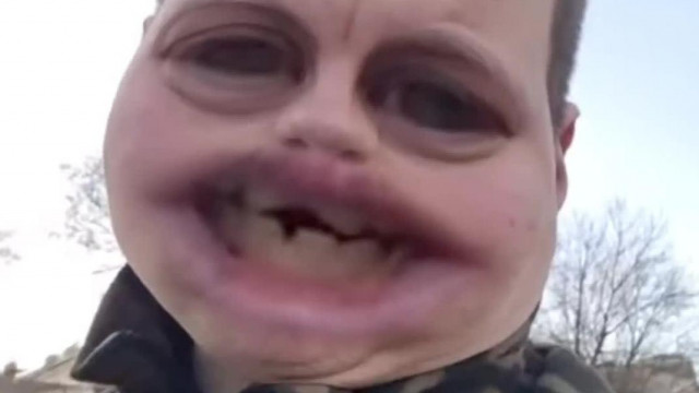 Alex a koldus melo nelkul