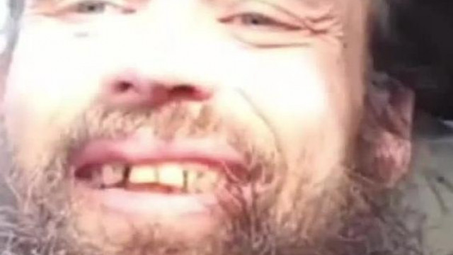 Bartos Möster őszinten bevallja: 35 ève nem mosott fogat